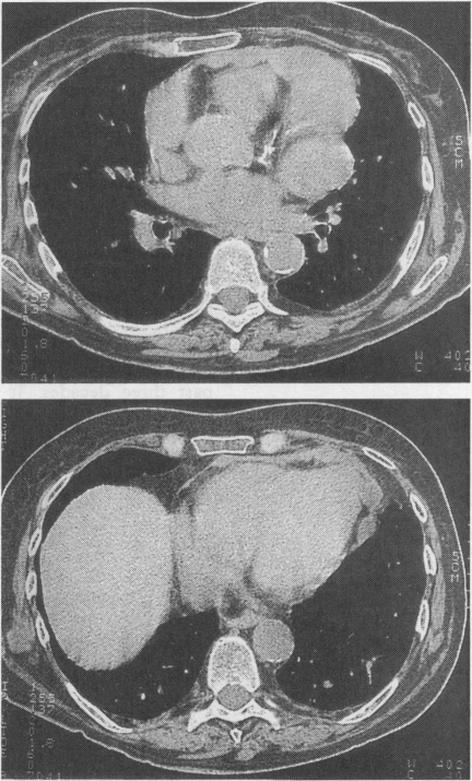 FIG 1