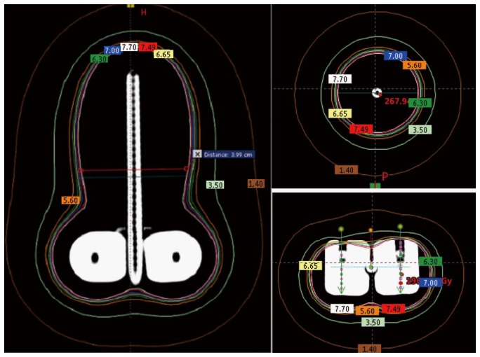 Figure 5