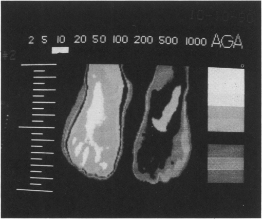 Fig. 3-B