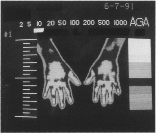 Fig. 1-C