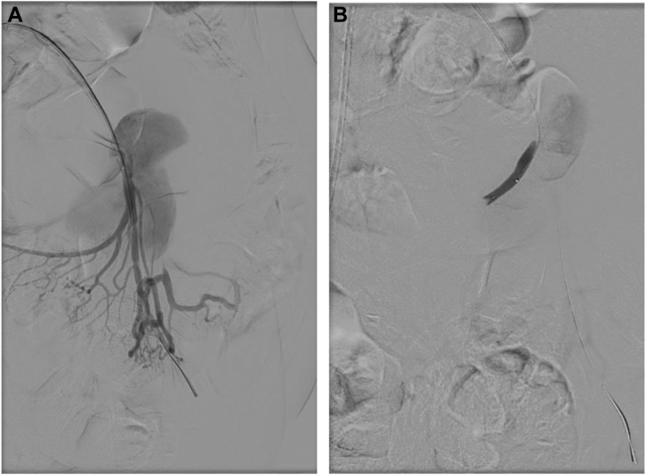 Fig 2