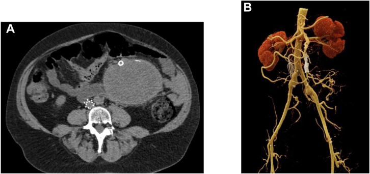 Fig 4