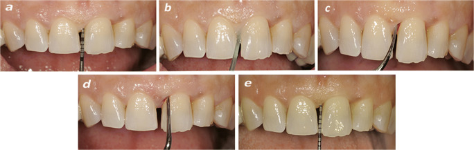 Fig. 1