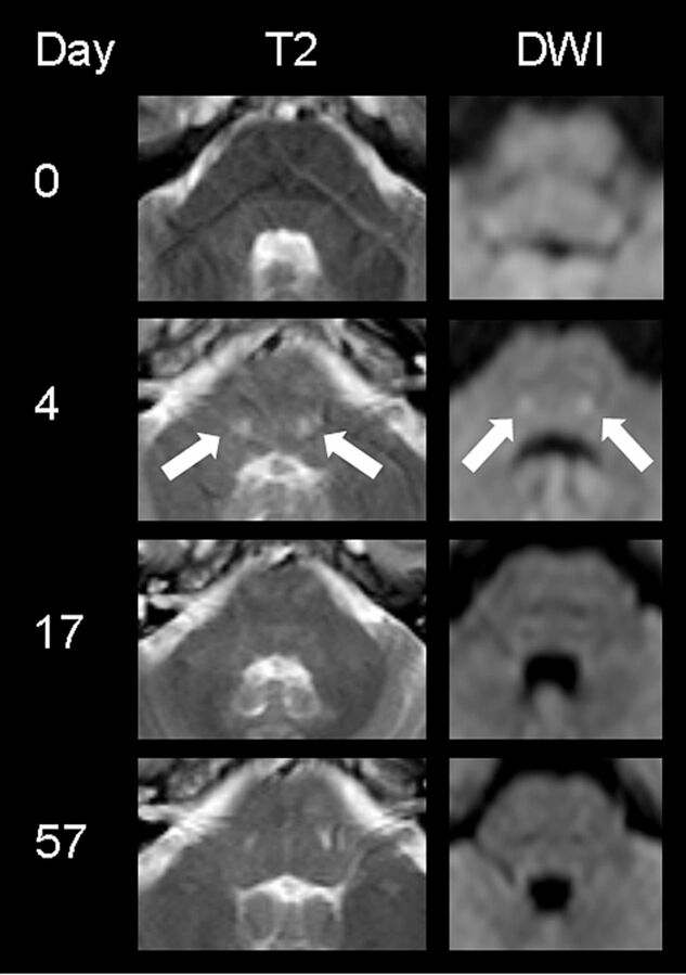 Fig 2.