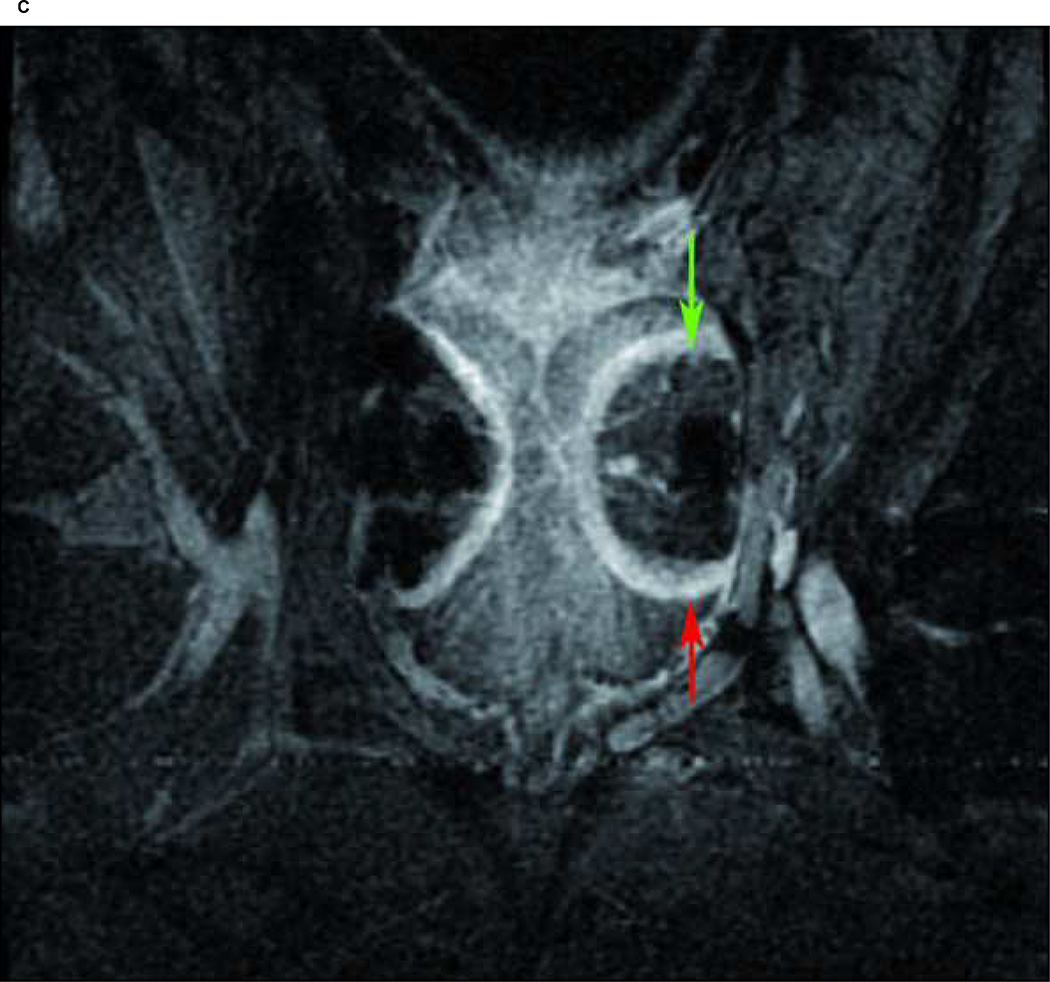 Fig. 2: