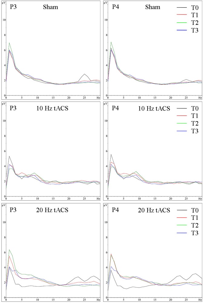 FIGURE 11