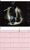 FIG. 2.