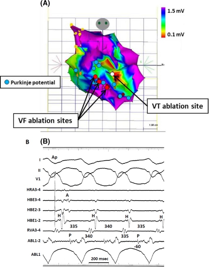 Figure 9‐5