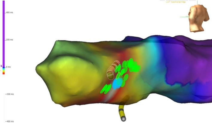 Figure 11‐3