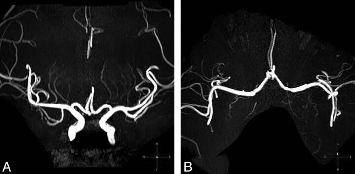Fig 3.