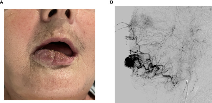 Figure 1