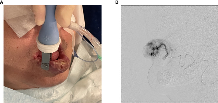 Figure 3