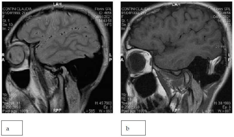 Figure 20