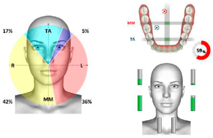 Figure 21