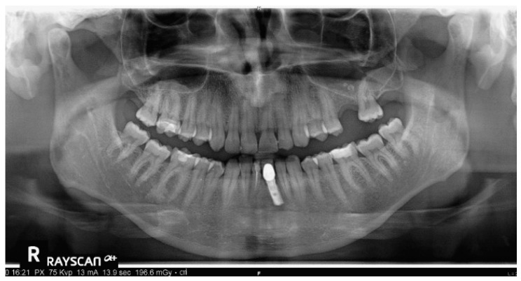 Figure 26