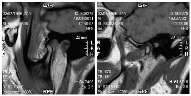 Figure 27