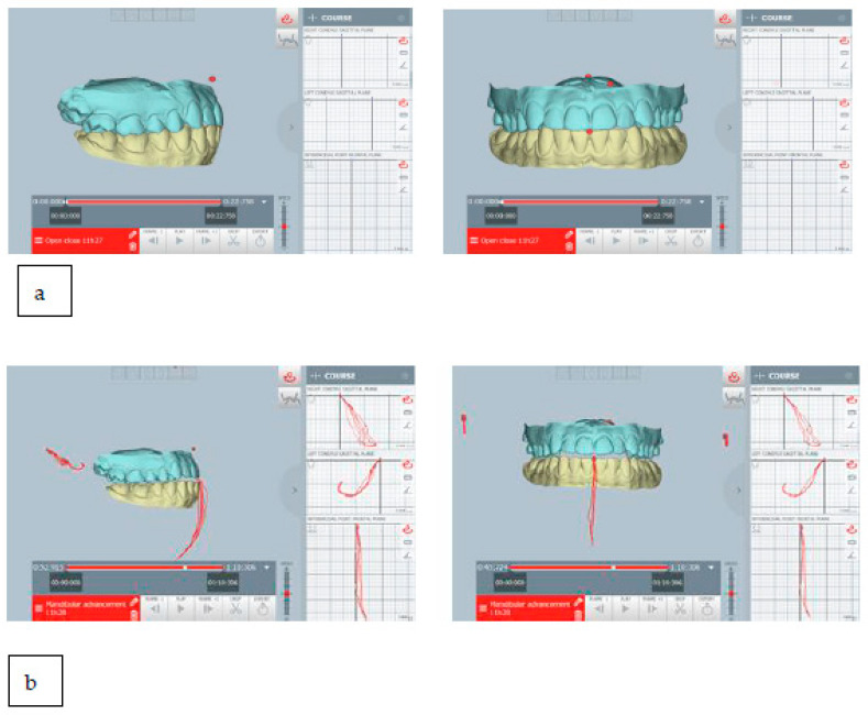 Figure 22