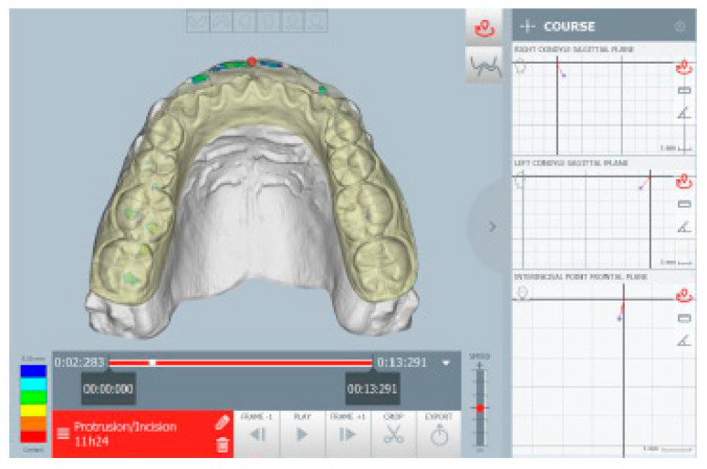 Figure 18