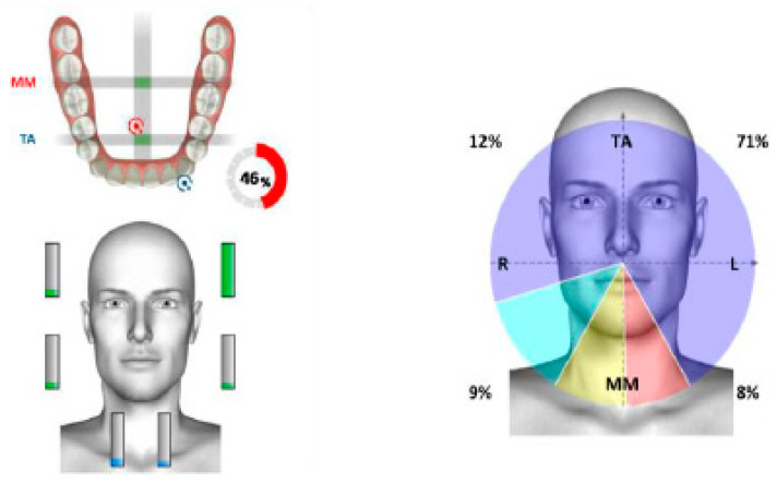 Figure 28