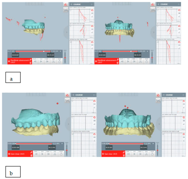 Figure 30