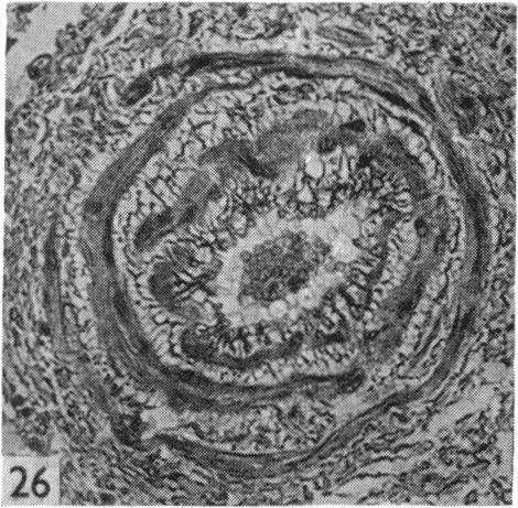 Fig. 26