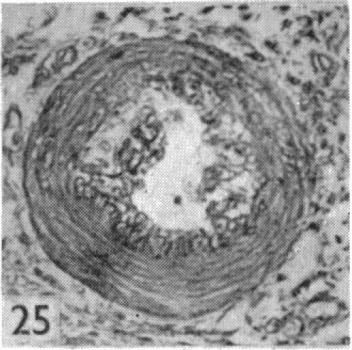 Fig. 25