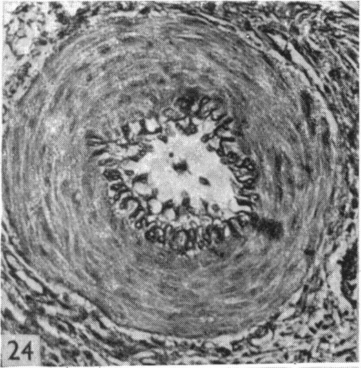 Fig. 24