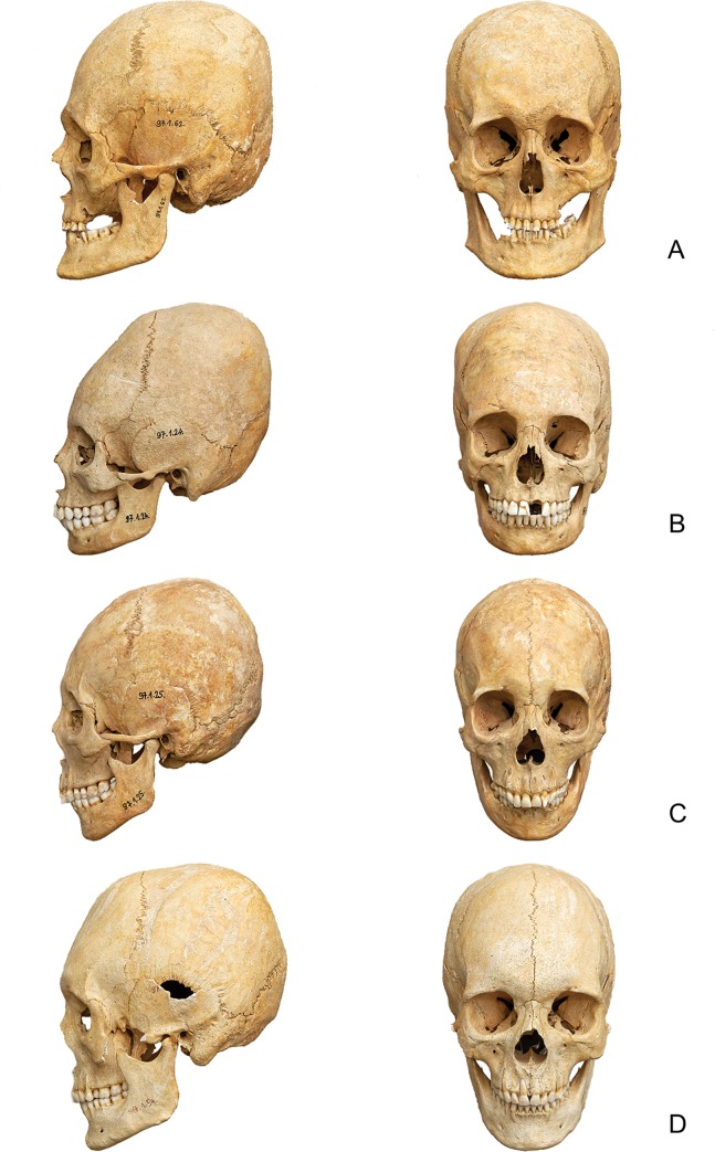 Fig 3