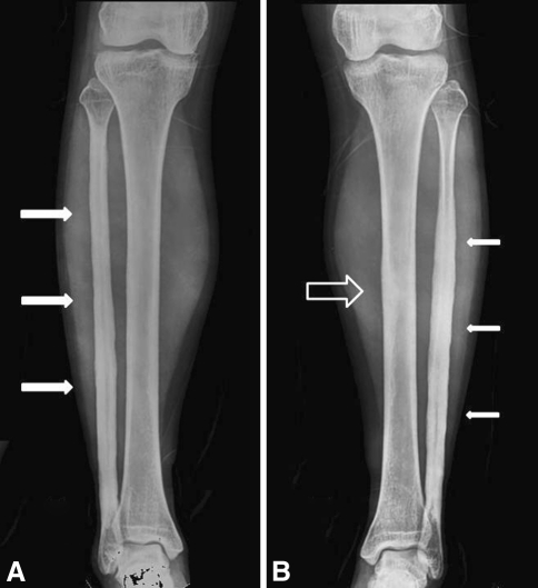 Fig. 2A–B