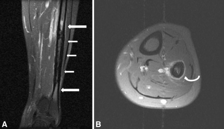 Fig. 1A–B