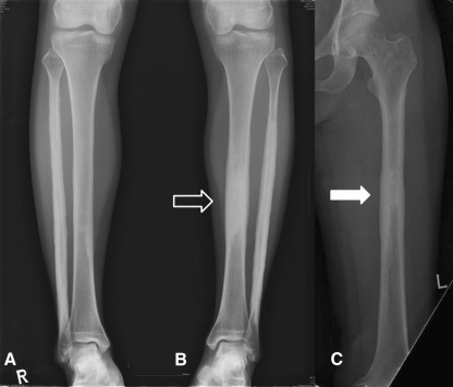 Fig. 5A–C