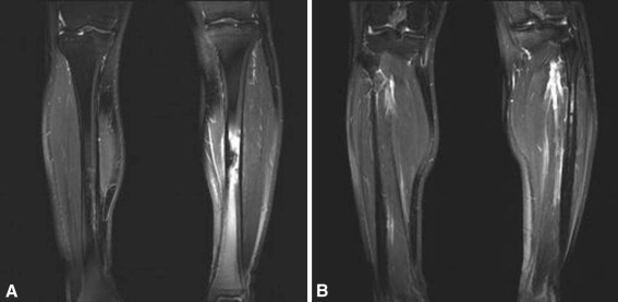 Fig. 3A–B