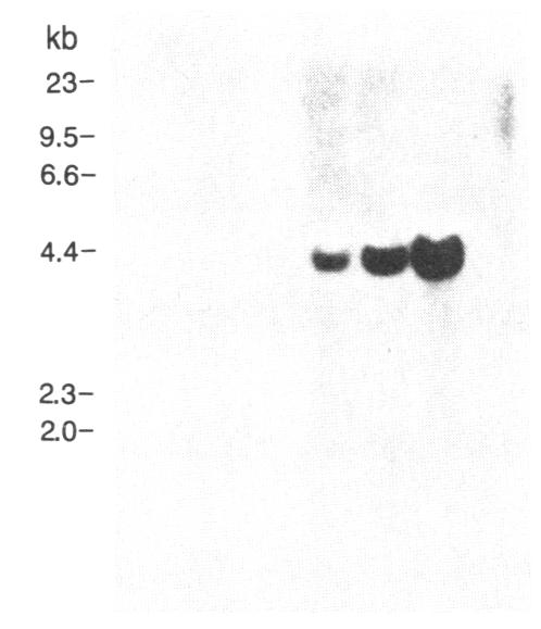 graphic file with name pnas00362-0199-a.jpg