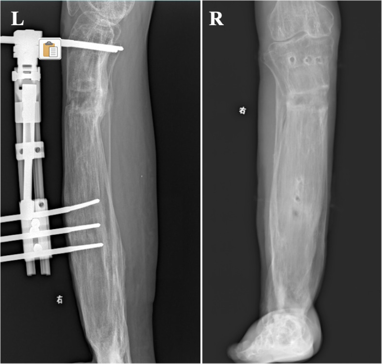 Fig. 11