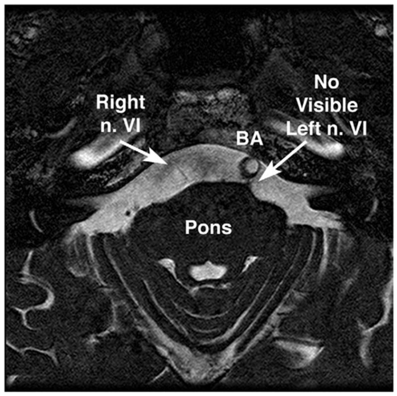 FIG 10