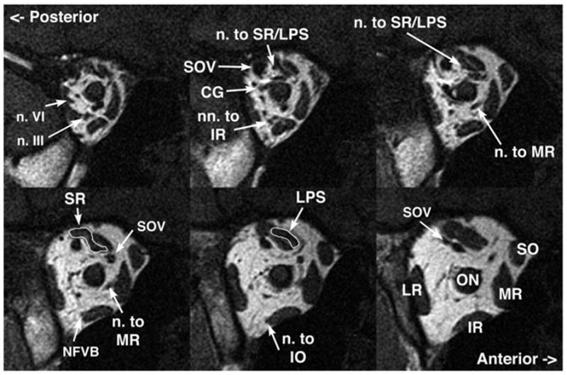 FIG 1