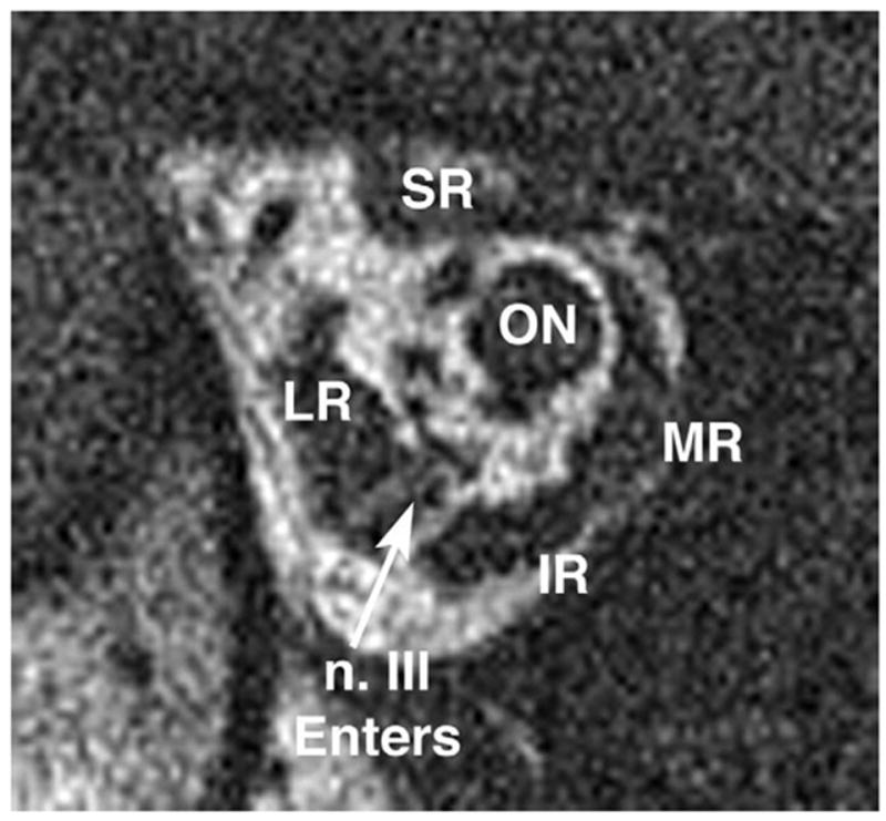 FIG 11