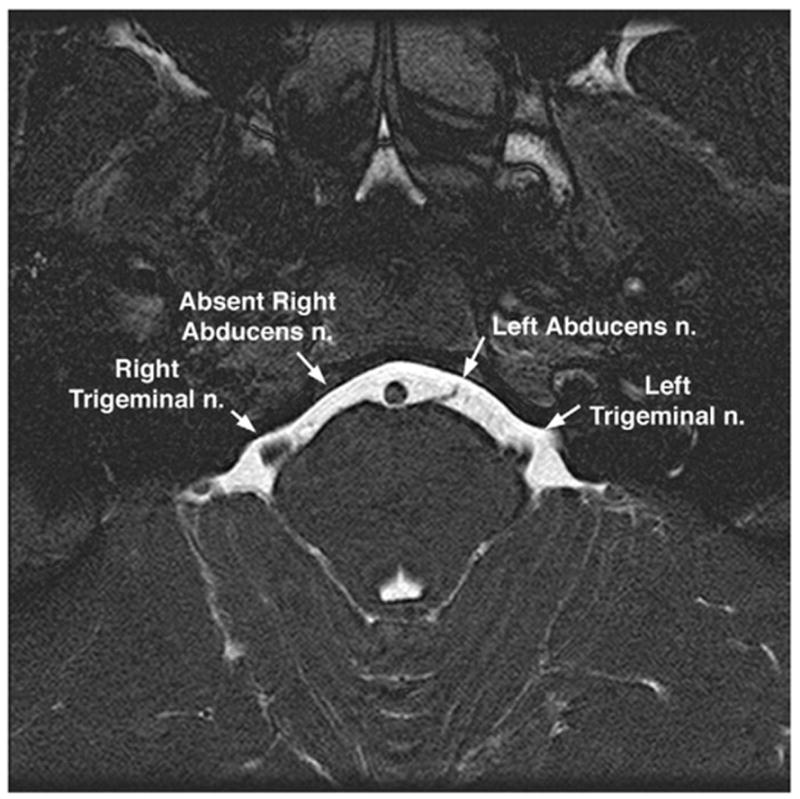 FIG 12