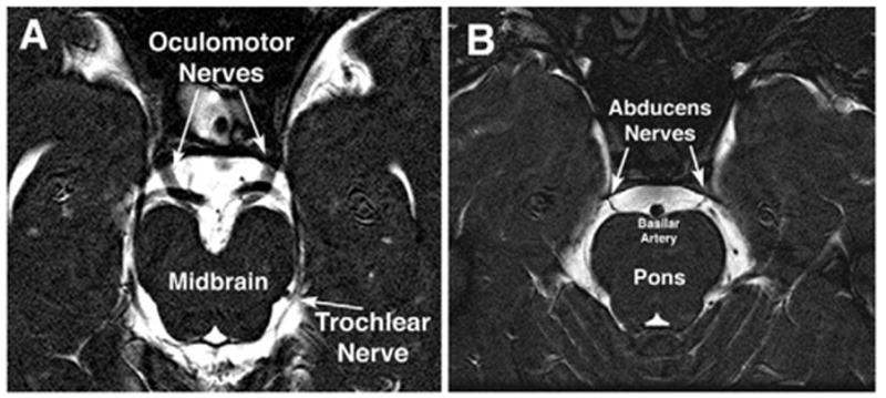 FIG 2