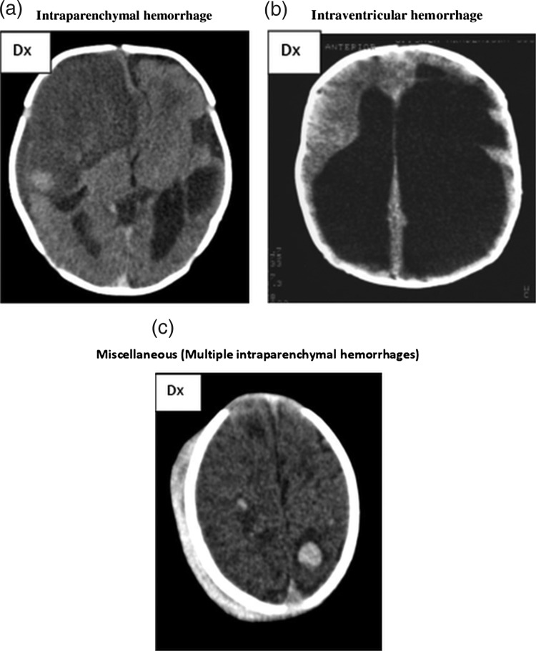 Figure 3