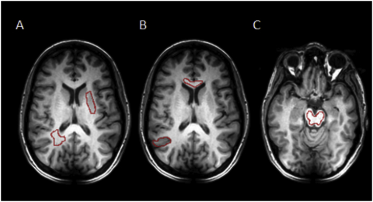 Fig. 2