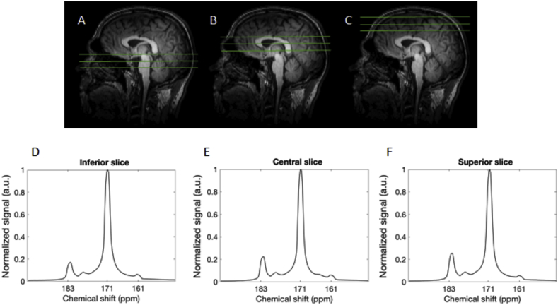 Fig. 3