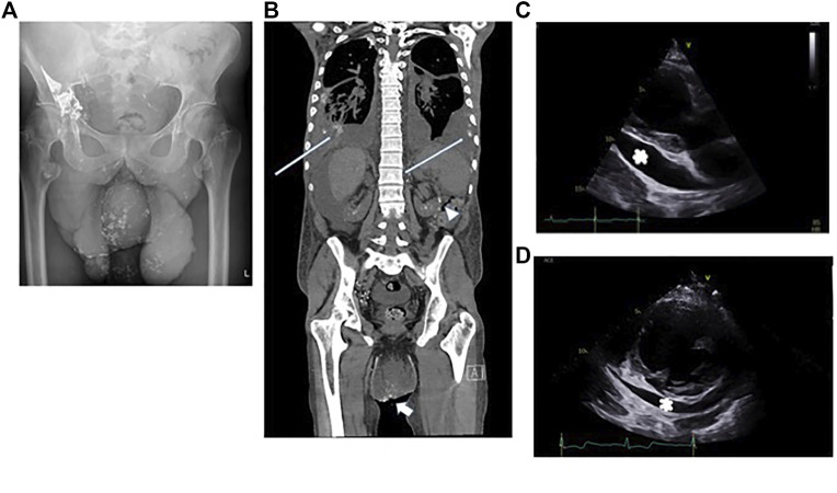 FIGURE 4