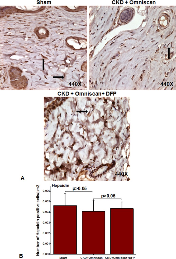 Fig 11