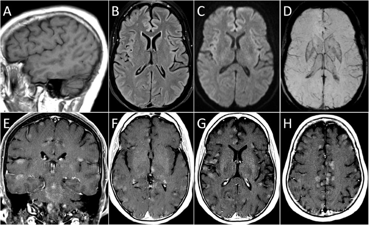 Fig. 1