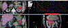 Fig. 1 –