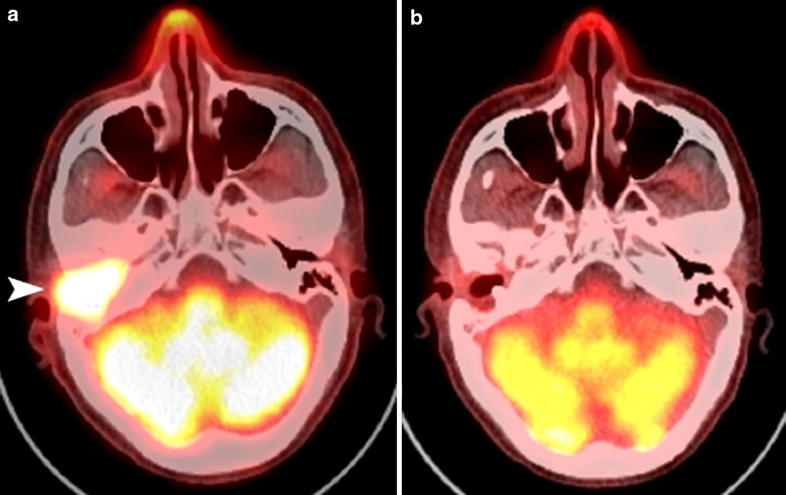 Fig. 5