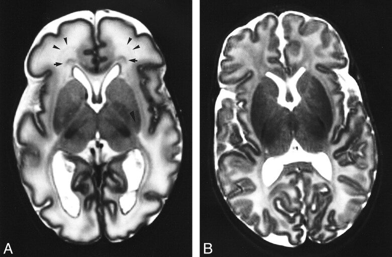 fig 3.