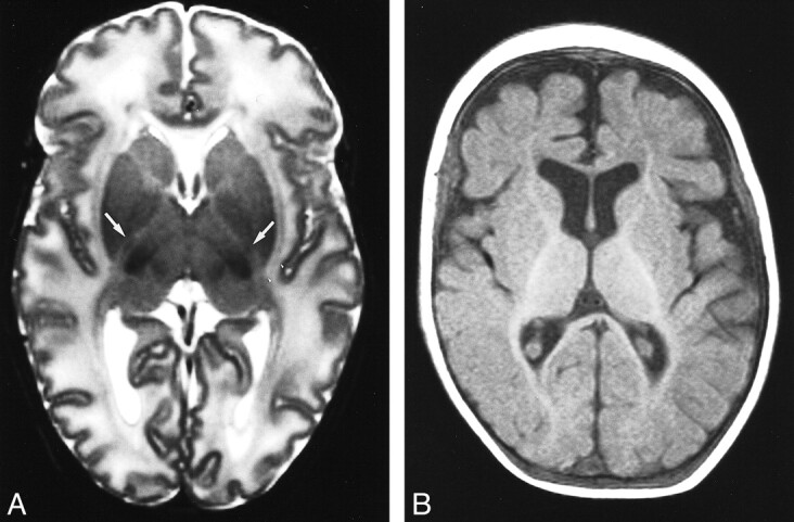 fig 2.