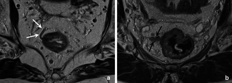 Fig. 11